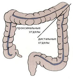 Проксимальные и дистальные отделы толстого кишечника