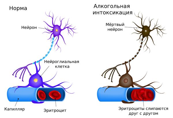 Алкоголь разрушает нейроны