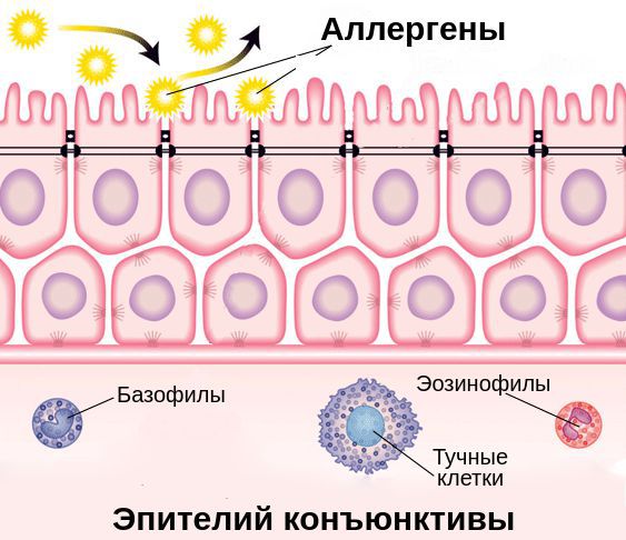 Эпителий конъюнктивы, устойчивый к аллергенам