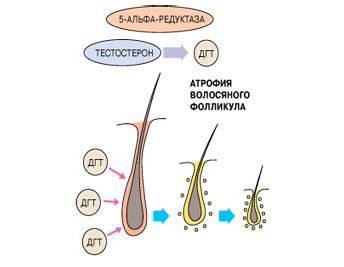 Действие ДГТ на волосянной фолликул