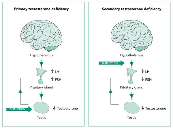 Первичный и вторичный андрогенный дефицит