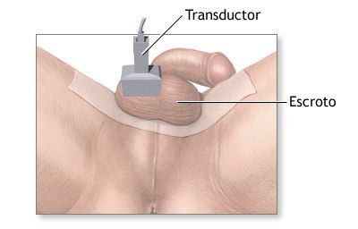 УЗИ мошонки