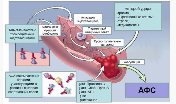Патогенез АФС