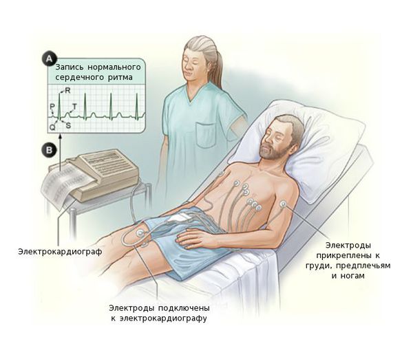 Электрокардиография