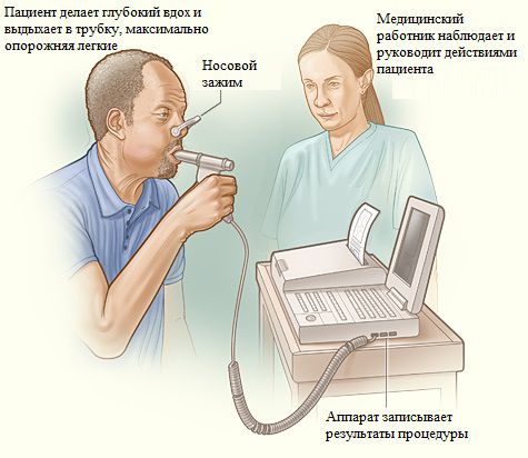 Спирометрия