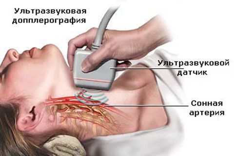 Ультразвуковая допплерография