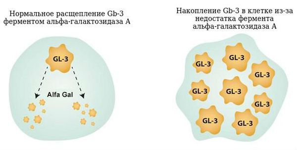 Нормальный процесс расщепления Gb-3 и патология