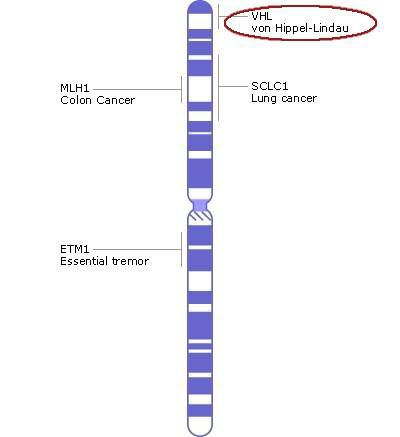 Хромосома 3, ген VHL