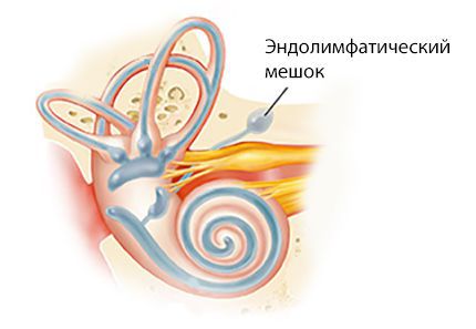 Эндолимфатический мешок