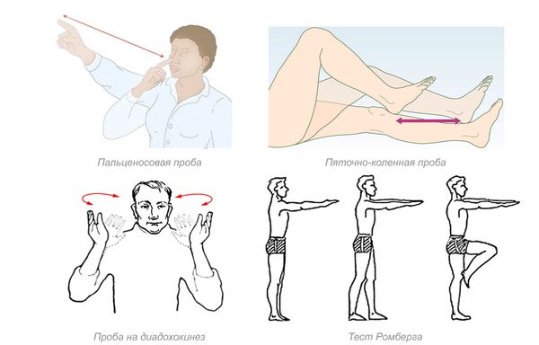 Неврологические пробы