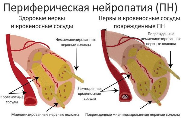 Повреждение кровеносных сосудов