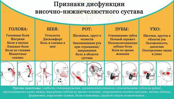 Симптомы дисфункции ВНЧС