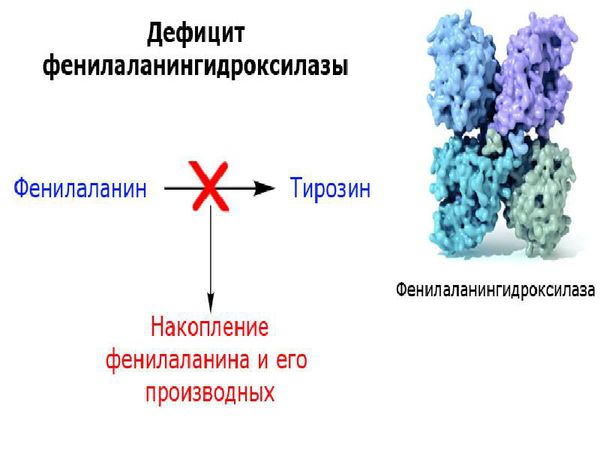 Дефицит фенилаланин-гидроксилазы