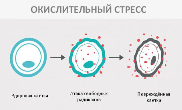 Окислительный стресс
