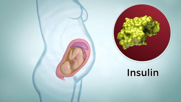 Развитие сахарного диабета во время беременности