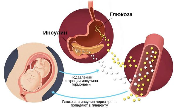 Физиологическая инсулинорезистентность