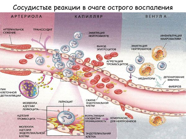 Сосудистые реакции в очаге острого воспаления