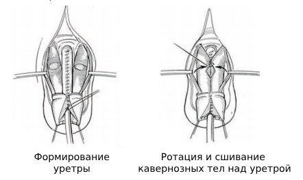 Операция Кантвелла — Рэнсли