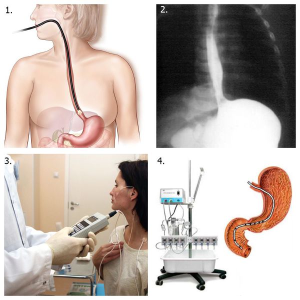 Инструментальные методы диагностики эзофагита