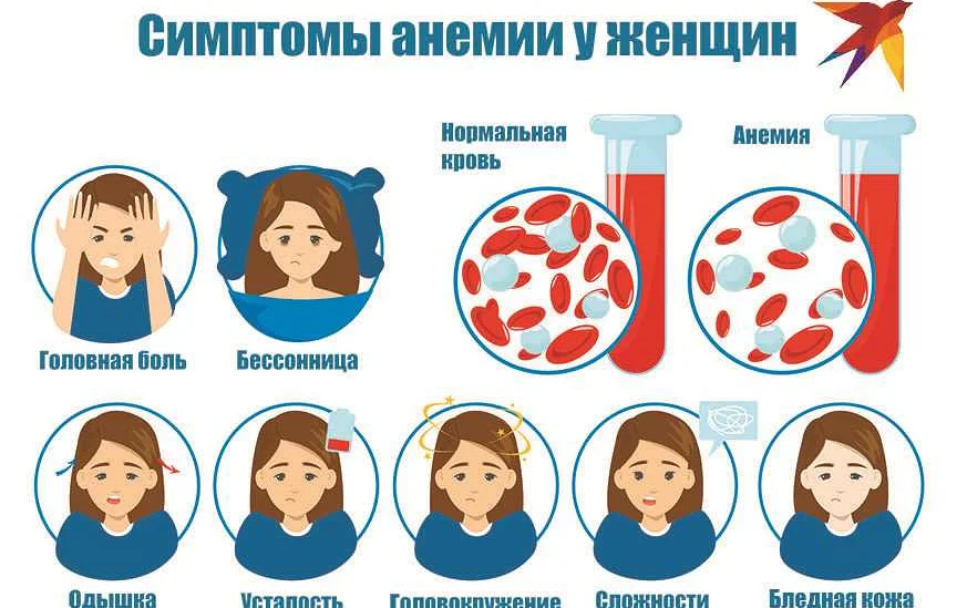 Причины развития железодефицитной анемии