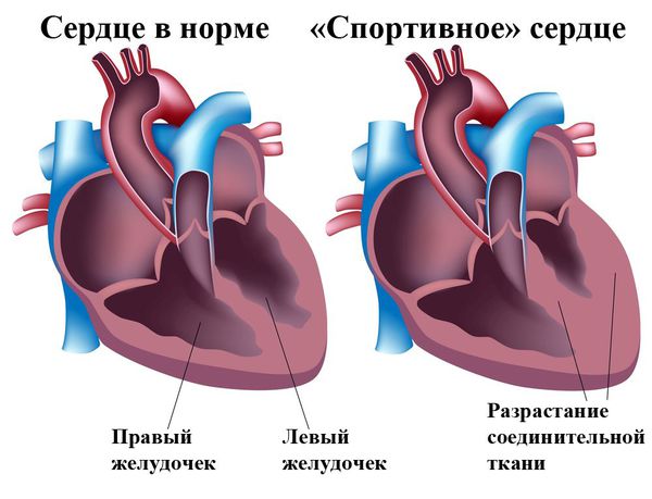 Спортивное сердце