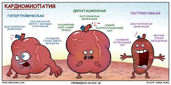 Самые распространённые виды кардиомиопатий