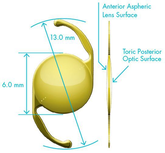 Торическая интраокулярная линза Alcon AcrySof IQ Toric
