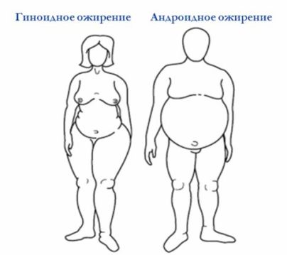 Типы отложения жира