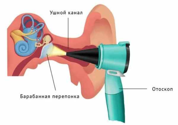 Отоскопия