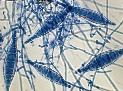 Microsporum canis 