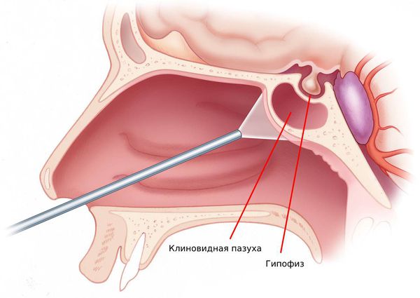 Расположение клиновидной пазухи и гипофиза