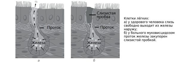 Закупорка протока железы