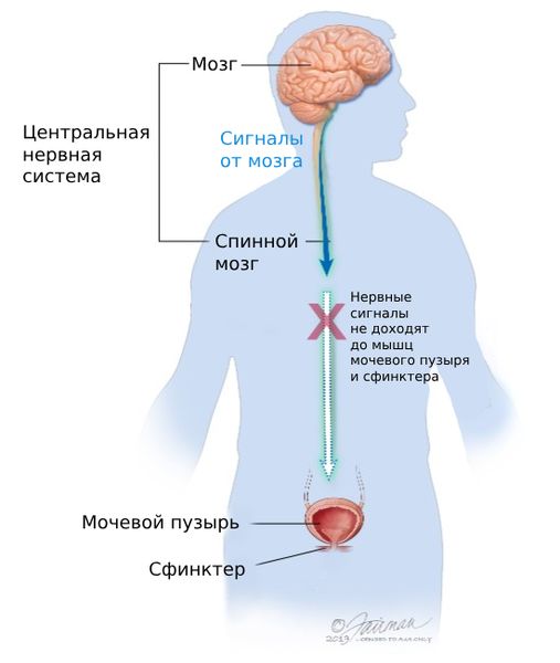 Нейрогенная дисфункция нижних мочевыводящих путей