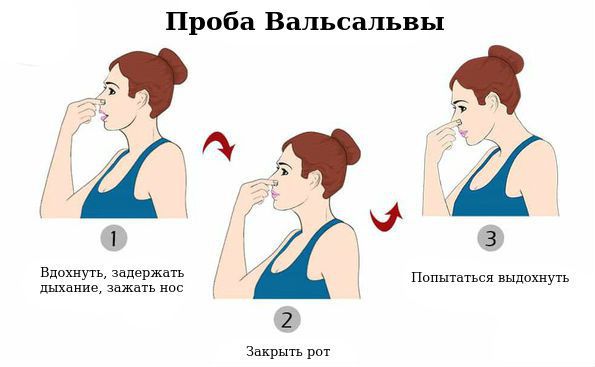 Проба Вальсальвы