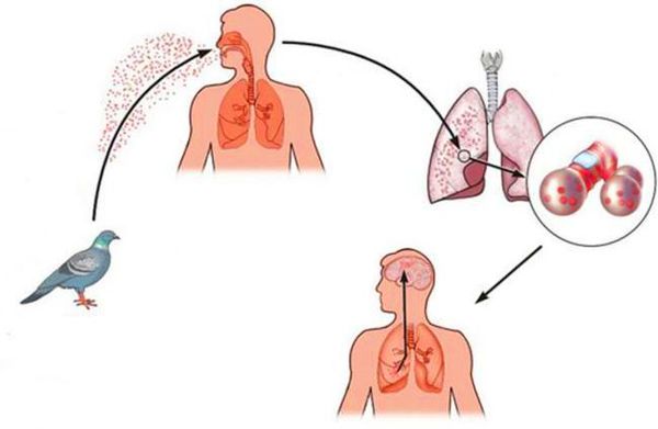 Заражение орнитозом
