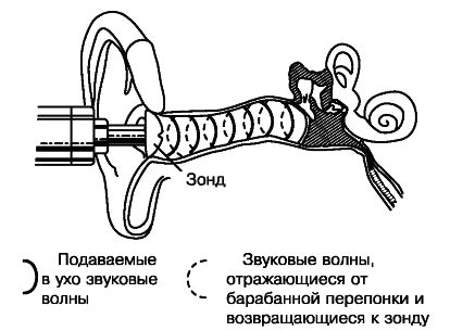 Тимпанометрия