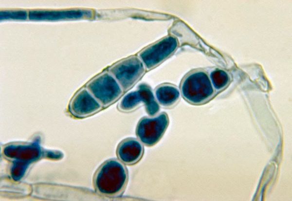 Грибок Epidermophyton floccosum