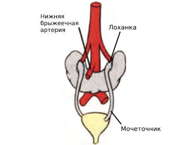 Формирование подковообразной почки