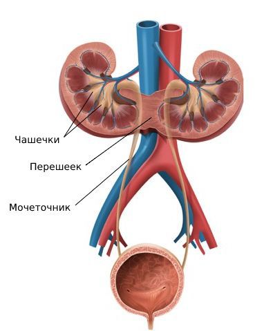 Подковообразная почка