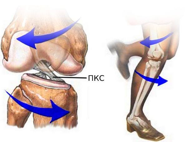 Скручивание в коленном суставе