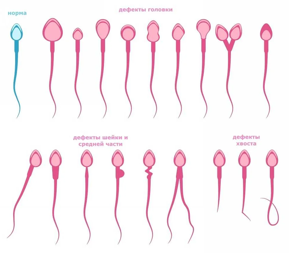 что можно определить по количеству спермы фото 24