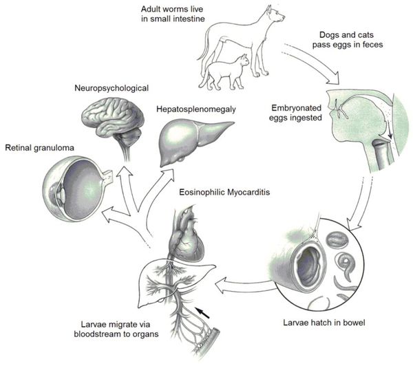 Распространение токсокар в организме человека