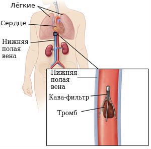 Кава-фильтр