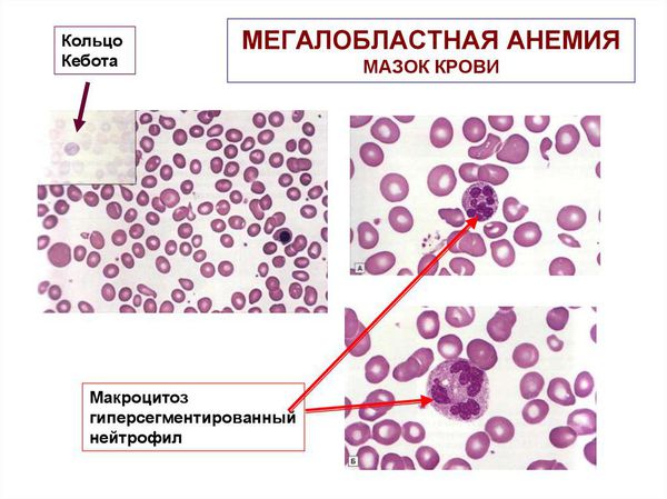 Мазок крови