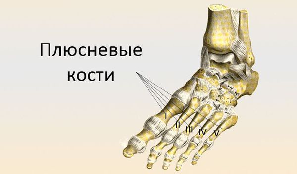 Плюсневые кости