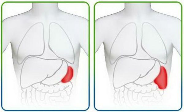 Увеличение селезёнки
